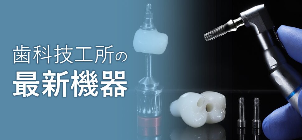 歯科技工所の最新機器の見出し画像